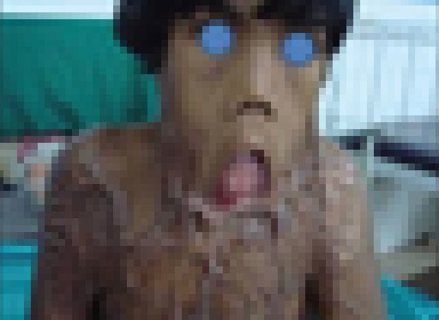 【超！閲覧注意】こうなったらもう生きてはいけないよな・・・（画像あり）