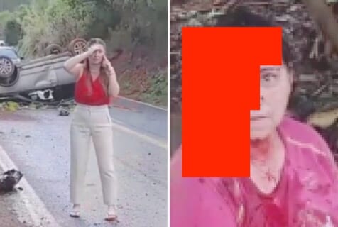 【閲覧注意】自動車事故で ”生きたまま顔がこうなった” 女性、冷静すぎて逆に怖いんだが…